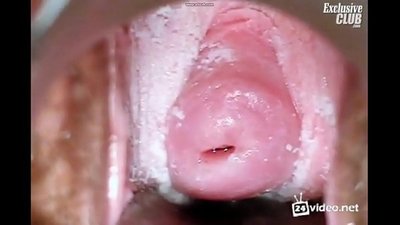 ujian Gynecological sahiji awéwé geulis